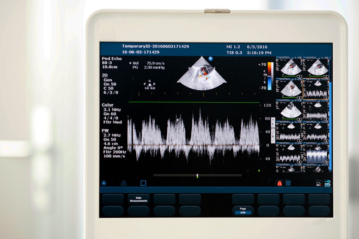 Image from echocardiography scan at Cooley Dickinson Hospital, 30 Locust Street, Northampton, MA 01060.