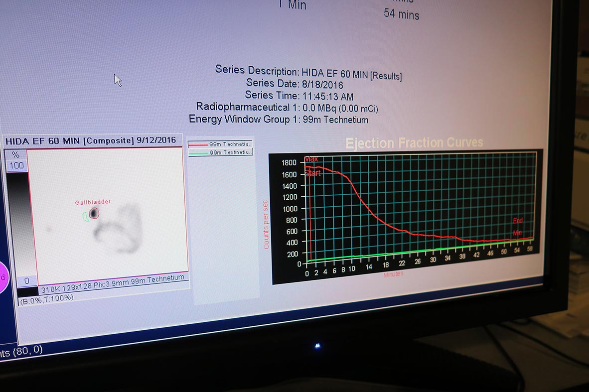 Readout from nuclear medicine scan at Cooley Dickinson Hospital, 30 Locust Street, Northampton, MA 01060.