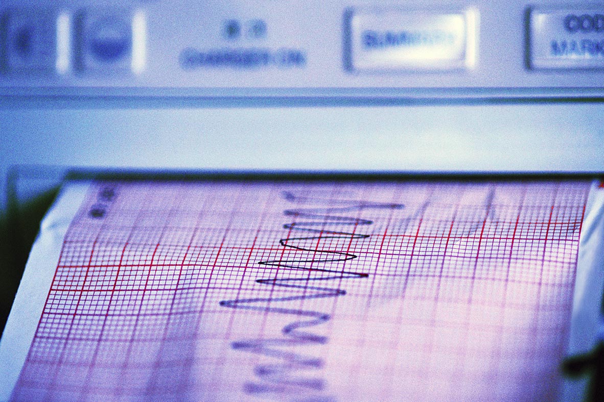 EKG readout, cardiovascular suite, Cooley Dickinson Hospital, 30 Locust Street, Northampton, MA 01060.