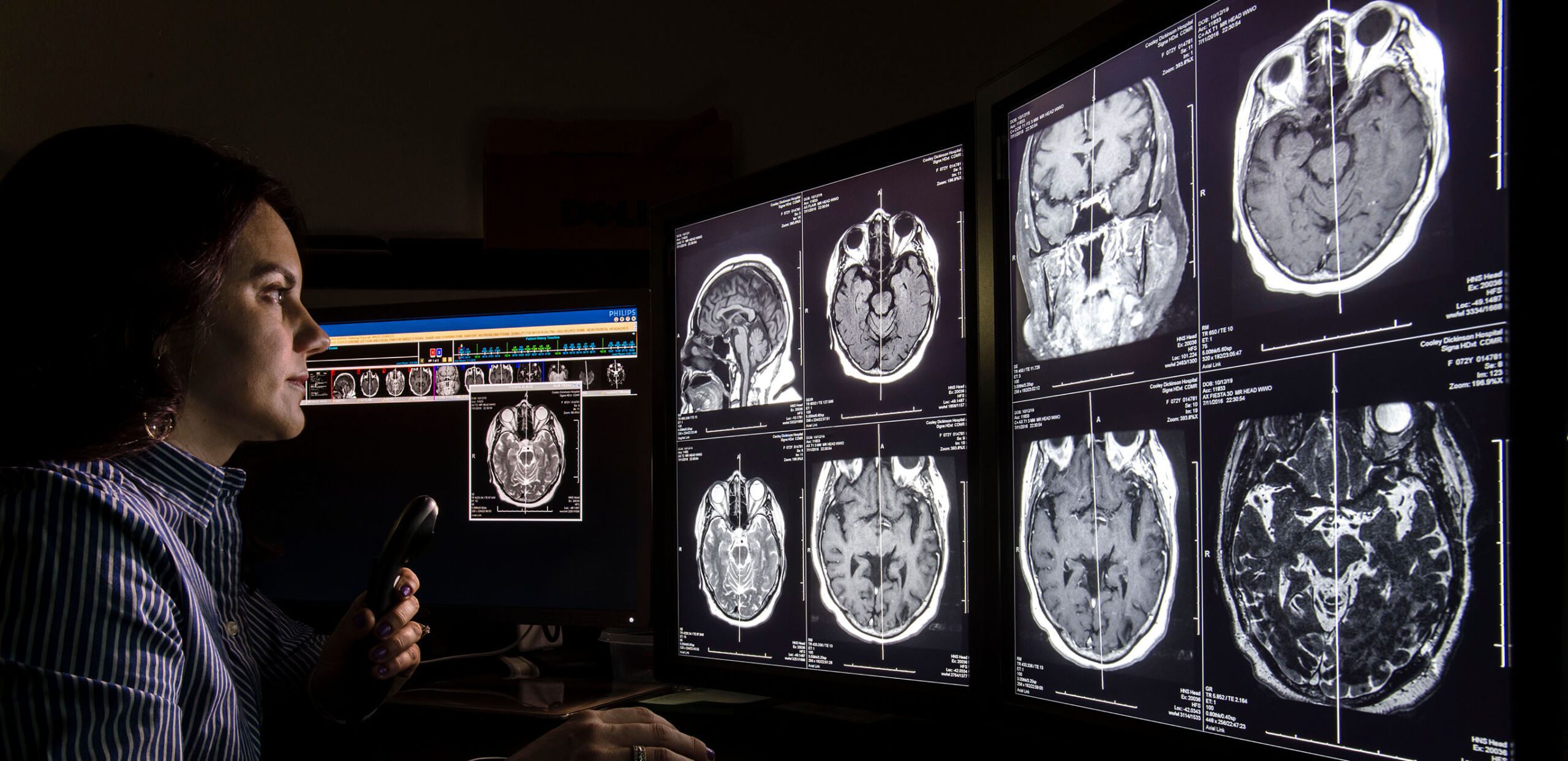 Radiologist Brooke Breen, MD, dictates notes while reviewing MRI scans of a patient's brain at Cooley Dickinson Hospital, 30 Locust Street, Northampton, MA 01060.