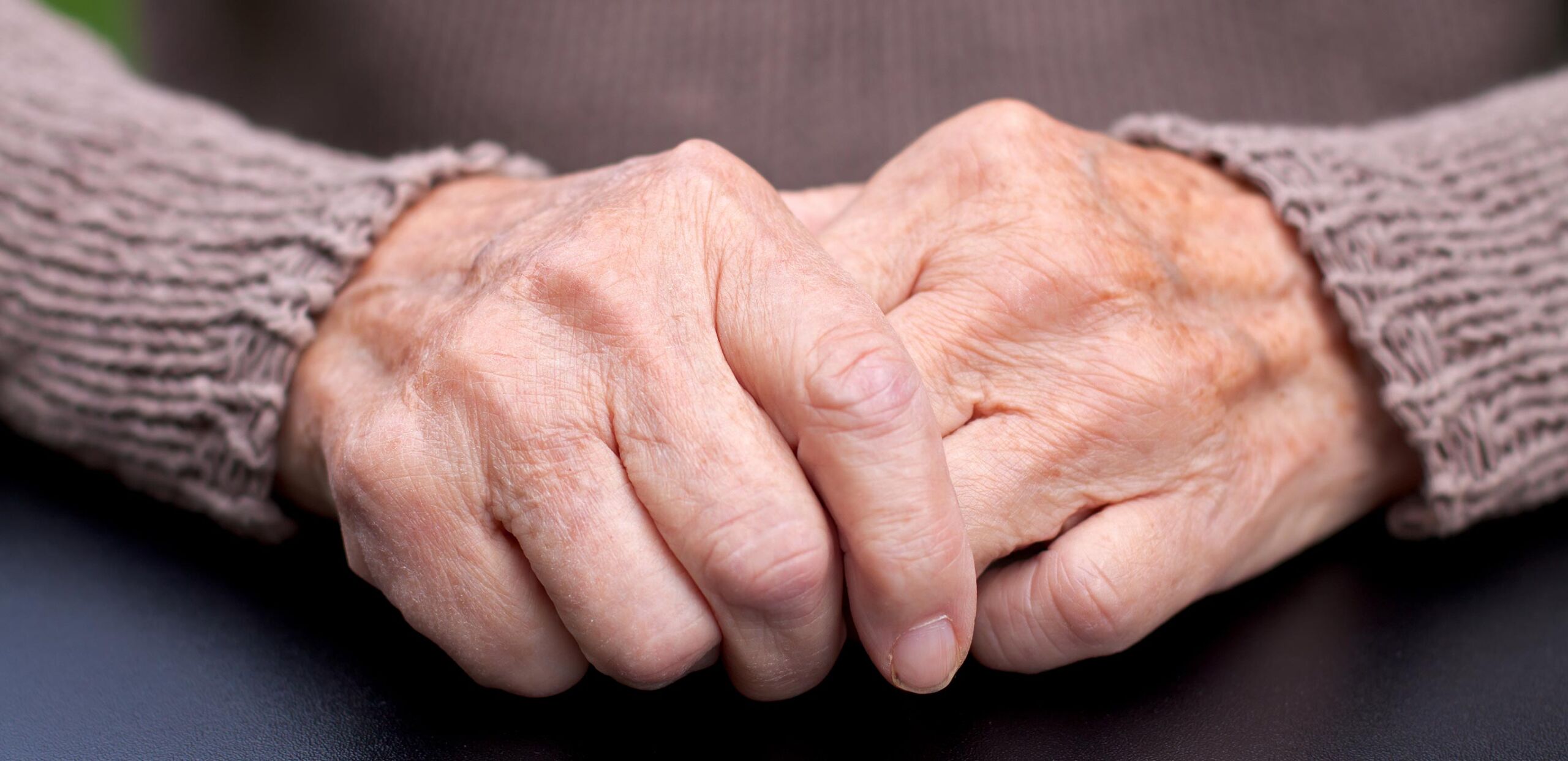 Elderly person's hands, Cooley Dickinson Medical Group Rheumatology, 22 Atwood Drive, Northampton, MA 01060.