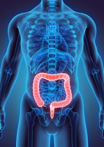 Rates of colorectal cancer have risen considerably in patients under 50 years old.